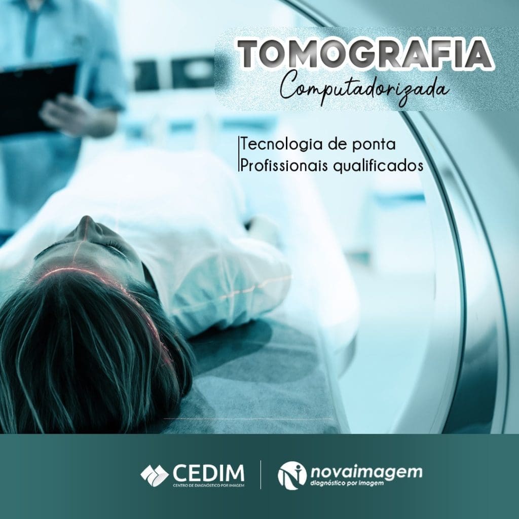 Tomografia Computadorizada Tomografia Computadorizada