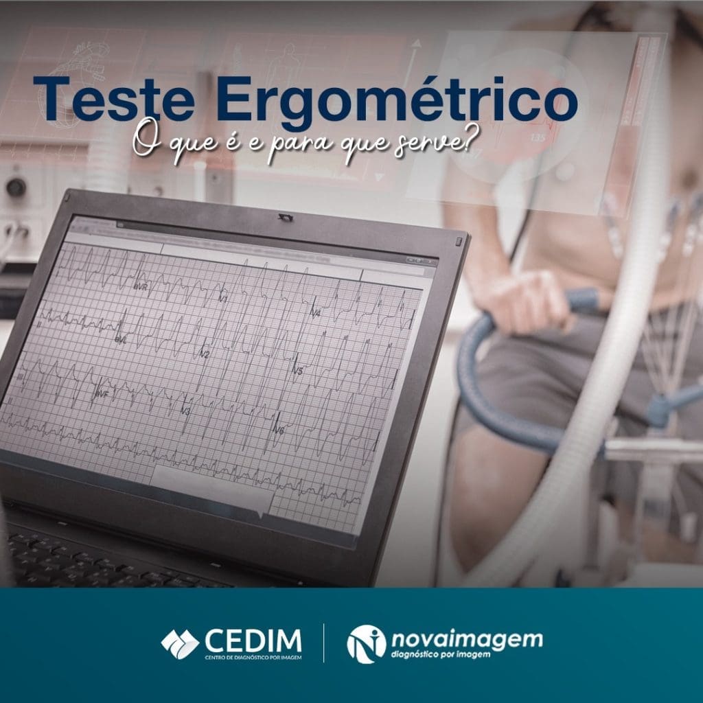 Teste Ergométrico: o que é e pra que serve ? Teste Ergométrico: o que é e pra que serve ?