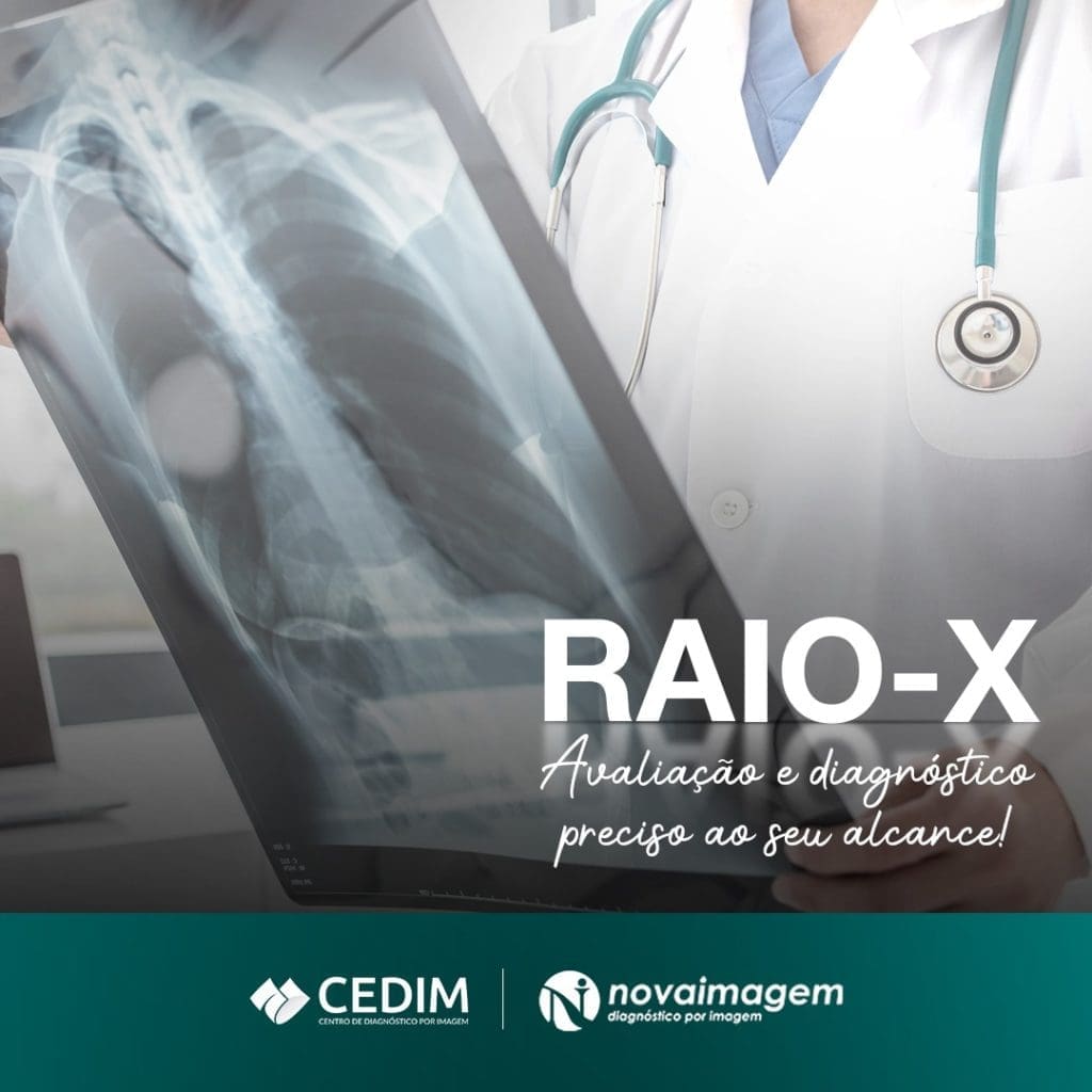 Raio-X Raio-X