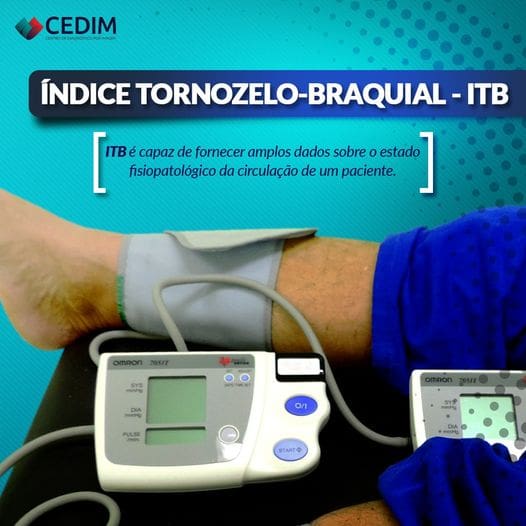 ITB – ÍNDICE TORNOZELO BRAQUIAL ITB – ÍNDICE TORNOZELO BRAQUIAL