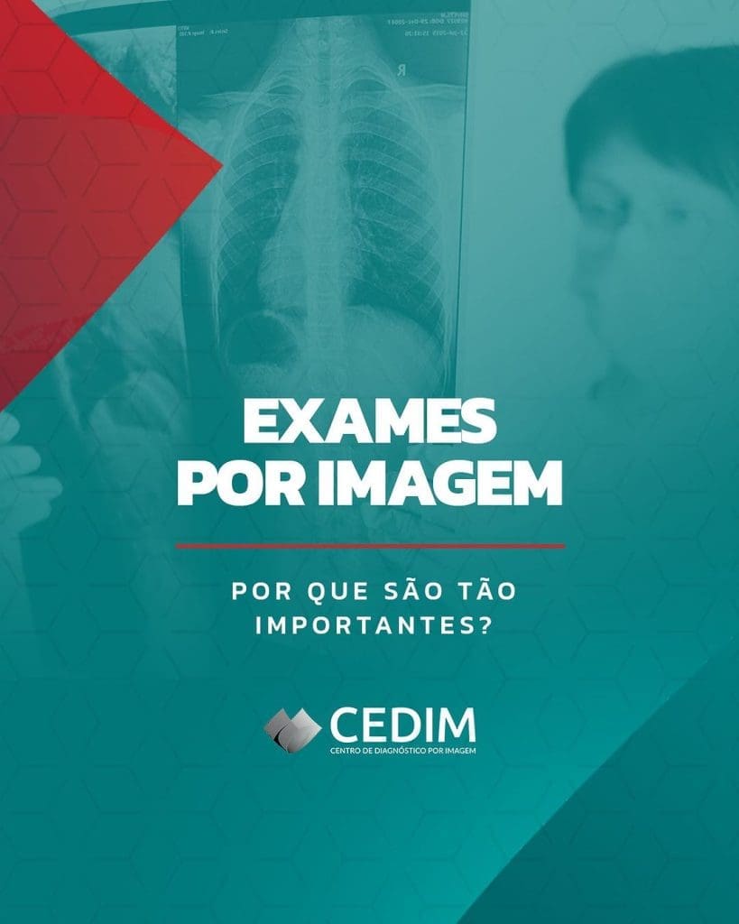 Exame por imagem por que são tão importante? Exame por imagem por que são tão importante?