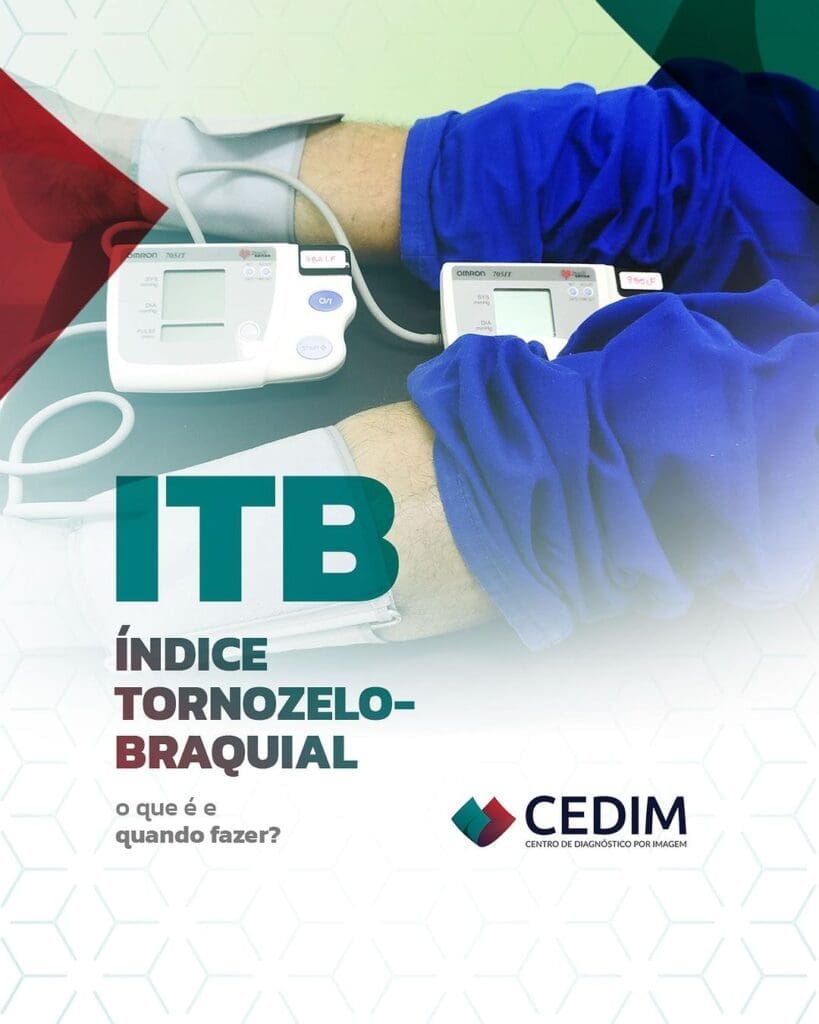 O exame do Índice Tornozelo-Braquial, conhecido como ITB