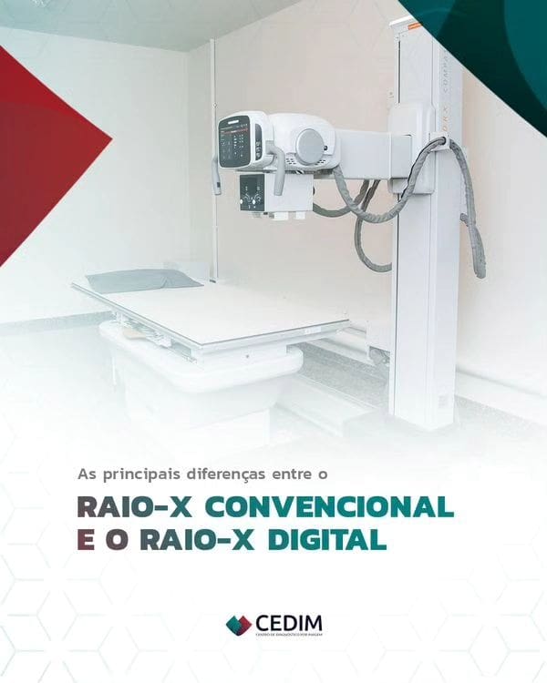 Você sabe qual a diferença entre o Raio-X convencional e o Raio-X digital? Você sabe qual a diferença entre o Raio-X convencional e o Raio-X digital?