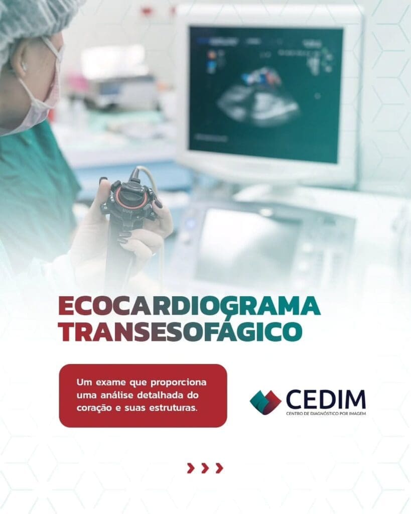 ecocardiograma transesofágico é um exame de imagem fundamental para uma análise mais precisa do funcionamento do seu coração. ecocardiograma transesofágico é um exame de imagem fundamental para uma análise mais precisa do funcionamento do seu coração.