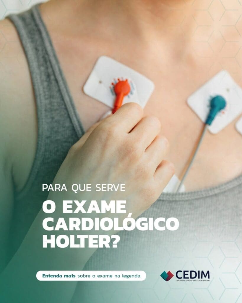 O Holter é um exame que monitora o ritmo cardíaco durante 24 horas, O Holter é um exame que monitora o ritmo cardíaco durante 24 horas,