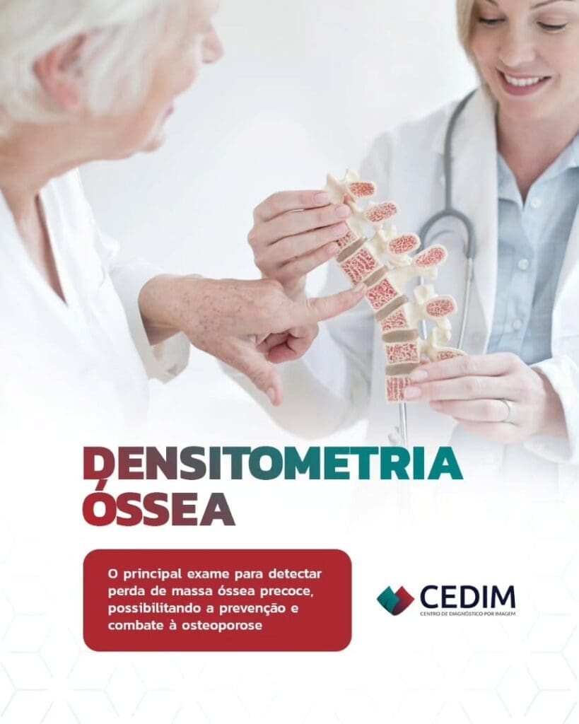 A densitometria óssea é o principal exame para avaliar a densidade mineral dos ossos e detectar precocemente a perda de massa óssea, condição que pode evoluir para osteopenia ou osteoporose se não for acompanhada com atenção. A densitometria óssea é o principal exame para avaliar a densidade mineral dos ossos e detectar precocemente a perda de massa óssea, condição que pode evoluir para osteopenia ou osteoporose se não for acompanhada com atenção.